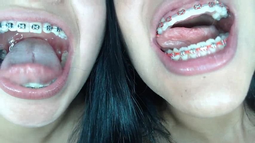 Poster for Mia_Isabella3 - Miaisabella3 Braces Mouth Uvula Fetish - Manyvids Model - Mouth Fetish, Close-Ups (My_Isabella3 Крупные Планы)