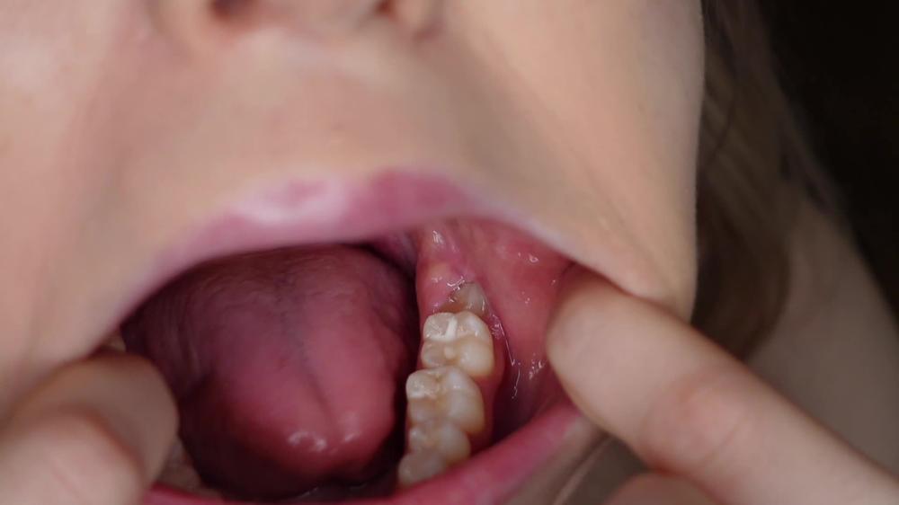 Poster for Manyvids Girl - Teeth And Molars Tour Dental History - Sofie Skye - Tongue Fetish, Mouth Fetish, Throat Fetish (Софи Скай Фетиш Рта)