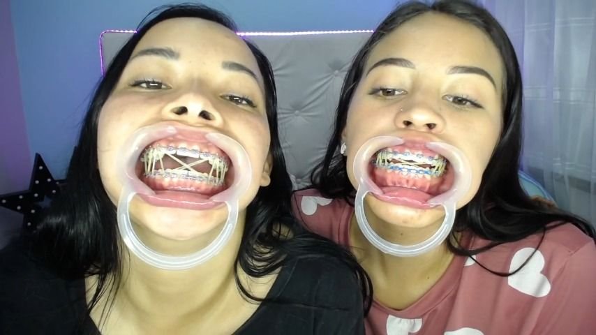 Poster for Mia_Isabella3 - Miaisabella3 Our Mouths Braces And Tongue Tour - Manyvids Girl - Spit Fetish, Braces, Teeth (My_Isabella3 Брекеты)